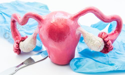 输卵管复扎术需要切子宫吗？子宫输卵管造影术的禁忌证？